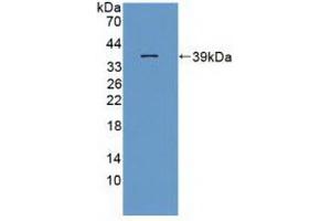 Western blot analysis of recombinant Rat ITaC. (CXCL11 anticorps  (AA 22-100))