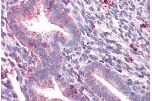 Anti-STEAP2 antibody  ABIN960822 IHC staining of human uterus.