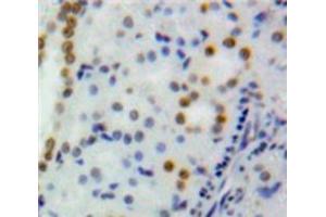 Used in DAB staining on fromalin fixed paraffin-embedded Kidney tissue (DNMT1 anticorps  (AA 1343-1570))