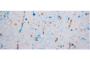 GPR39 expression in aged dlPFC human brains using ABIN1048812 (blue).