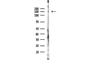 Western blot analysis of lysates from 293 cells(heat-shock 45 min treatment), using CD44 Antibody at 1/1000 dilution.
