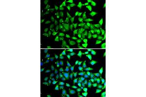 Immunofluorescence analysis of A549 cells using COPS6 antibody (ABIN5974254). (COPS6 anticorps)
