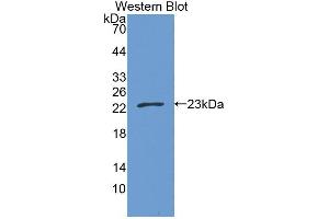 Western blot analysis of the recombinant protein. (CPT1B anticorps  (AA 602-772))