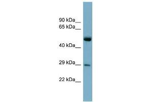WB Suggested Anti-RAB27A Antibody Titration: 0. (RAB27A anticorps  (Middle Region))