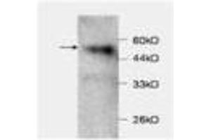 Image no. 1 for anti-Chemokine (C-C Motif) Ligand 2 (CCL2) antibody (ABIN791499) (CCL2 anticorps)