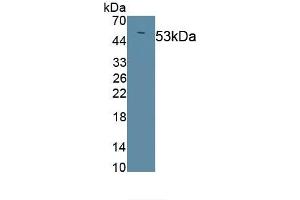 Detection of Recombinant PIIINP, Mouse using Polyclonal Antibody to Procollagen III N-Terminal Propeptide (PIIINP)