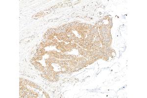 Immunohistochemistry (IHC) image for anti-DEAD (Asp-Glu-Ala-Asp) Box Polypeptide 6 (DDX6) (AA 1-50) antibody (ABIN7453871) (DDX6 anticorps  (AA 1-50))