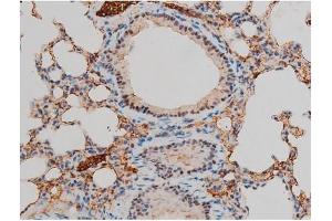 ABIN6267395 at 1/200 staining Mouse lung tissue sections by IHC-P.
