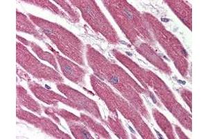 Immunohistochemistry (IHC) image for anti-Nuclear Receptor Subfamily 1, Group D, Member 2 (NR1D2) (C-Term) antibody (ABIN2470775)