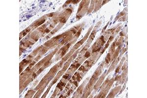 ABIN6266808 at 1/100 staining human Skeletal muscle tissue sections by IHC-P. (C2orf40 anticorps  (C-Term))