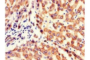 Immunohistochemistry of paraffin-embedded human liver tissue using ABIN7157253 at dilution of 1:100