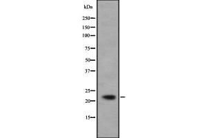 Western blot analysis IFNA5 using COS7 whole cell lysates (IFNA5 anticorps)