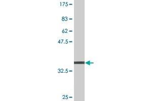 Western Blot detection against Immunogen (37.