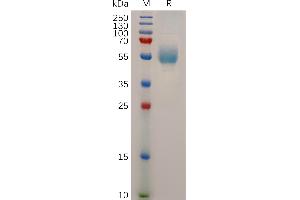 Human GCGR Protein, hFc Tag on SDS-PAGE under reducing condition.