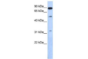 WB Suggested Anti-SENP5 Antibody Titration: 0. (SENP5 anticorps  (Middle Region))