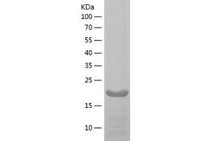 Western Blotting (WB) image for Matrix Metallopeptidase 9 (Gelatinase B, 92kDa Gelatinase, 92kDa Type IV Collagenase) (MMP9) (AA 532-707) protein (His tag) (ABIN7123861)