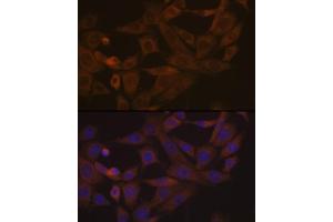 Immunofluorescence analysis of NIH-3T3 cells using Desmoglein 3 Rabbit mAb (ABIN7266741) at dilution of 1:100 (40x lens).