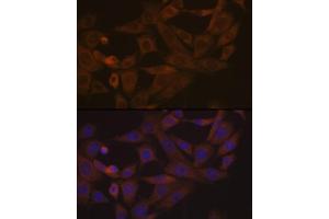 Immunofluorescence analysis of NIH-3T3 cells using Desmoglein 3 Rabbit mAb (ABIN7266741) at dilution of 1:100 (40x lens). (Desmoglein 3 anticorps)