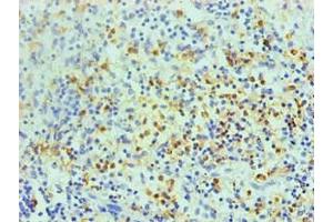 Immunohistochemical of paraffin-embedded human spleen using ABIN7168559 at dilution of 1:200 (S100A8 anticorps)