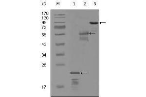 Western blot analysis using ERBB3 mouse mAb against truncated Trx-ERBB3 recombinant protein (1), MBP-ERBB3 (aa1175-1275) recombinant protein (2) and truncated ERBB3(aa665-1342)-hIgGFc transfected CH0-K1 cell lysate (3). (ERBB3 anticorps  (AA 1175-1275))