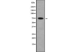 Western blot analysis FIGNL1 using HeLa whole cell lysates (FIGNL1 anticorps  (Internal Region))