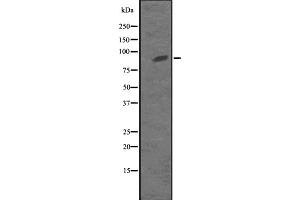 Western blot analysis of KIF23 expression in MKLP1 transfected 293T cell lysate,The lane on the left is treated with the antigen-specific peptide. (KIF23 anticorps  (Internal Region))