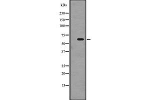 Western blot analysis of SRMS expression in A431 whole cell lysate ,The lane on the left is treated with the antigen-specific peptide.