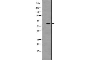 Western blot analysis of SRMS expression in A431 whole cell lysate ,The lane on the left is treated with the antigen-specific peptide. (SRMS anticorps  (C-Term))