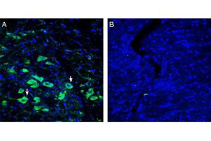 Expression of Platelet-activating factor receptor in rat substantia nigra pars compacta (SNC). (PTAFR anticorps  (Extracellular))
