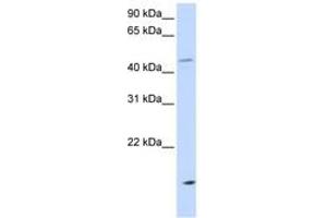 Image no. 1 for anti-Cholesteryl Ester Transfer Protein (CETP) (AA 36-85) antibody (ABIN6743588) (CETP anticorps  (AA 36-85))