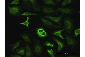 Immunofluorescence of purified MaxPab antibody to G6PD on HeLa cell.