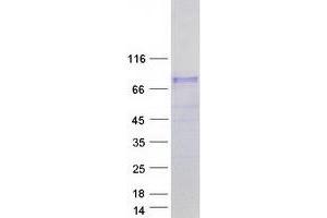 Validation with Western Blot