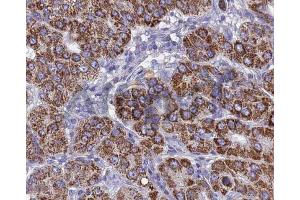 BMP3 Antibody for IHC in human testis.