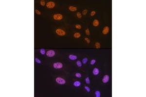 Immunofluorescence analysis of U-2 OS cells using PTBP2 Rabbit mAb (ABIN7269465) at dilution of 1:100 (40x lens). (PTBP2 anticorps)