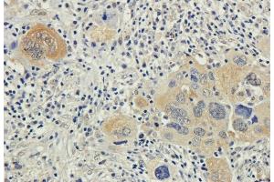 anti-Bax (Active Monomer) (AA 12-24), (AA 3-16) antibody