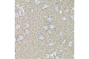 Immunohistochemistry of paraffin-embedded human brain using E/SLC1 Rabbit mAb (ABIN7270394) at dilution of 1:100 (40x lens).