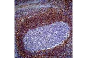 Immunohistochemical analysis of BCL2 staining in human tonsil formalin fixed paraffin embedded tissue section.