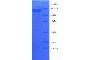Cathepsin D (CTSD) (AA 67-403), (partial) protein (GST tag) (Cathepsin D Protein (CTSD) (AA 67-403, partial) (GST tag))