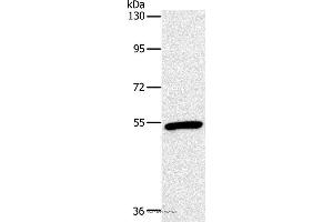 Western blot analysis of Mouse heart tissue, using OXTR Polyclonal Antibody at dilution of 1:866 (Oxytocin Receptor anticorps)
