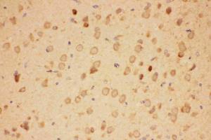 Anti-Hsp90-alpha-Picoband antibody,IHC(P): Rat Brain Tissue