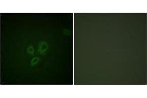 Immunofluorescence (IF) image for anti-Cardiac Troponin I (TNNI3) (AA 5-54) antibody (ABIN2888707) (TNNI3 anticorps  (AA 5-54))