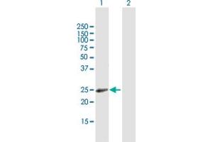 Western Blot analysis of RAB31 expression in transfected 293T cell line by RAB31 MaxPab polyclonal antibody. (RAB31 anticorps  (AA 1-195))