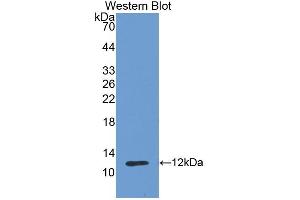 Detection of Recombinant CDHE, Gallus using Polyclonal Antibody to E-cadherin