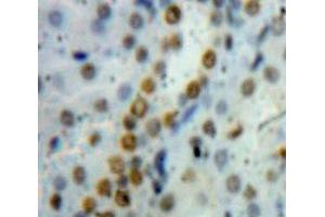 Used in DAB staining on fromalin fixed paraffin-embedded Kidney tissue (HMGB1 anticorps  (AA 1-215))