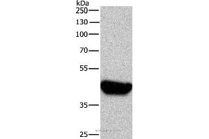 Western blot analysis of A431  , using BRE Polyclonal Antibody at dilution of 1:750