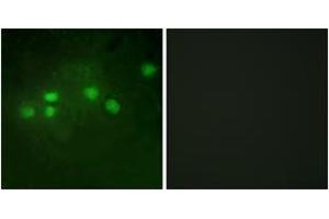 Immunofluorescence analysis of A549 cells, using ELF1 Antibody. (ELF1 anticorps  (AA 537-586))