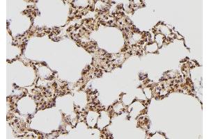 ABIN6269273 at 1/100 staining Rat lung tissue by IHC-P. (Tuberin anticorps  (Internal Region))