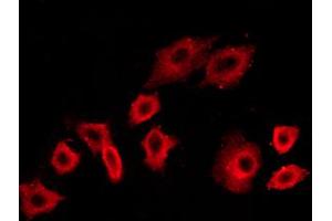 ABIN6267453 staining NIH/3T3 cells by ICC/IF. (PI3K p85 alpha/gamma anticorps  (pTyr199, pTyr467))