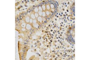 Immunohistochemistry of paraffin-embedded human colon using PRKCE antibody at dilution of 1:200 (x400 lens).