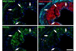 Arterial tissue sections (Fig.